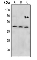 WB - Anti-MKK4 (pS257) Antibody AP61081